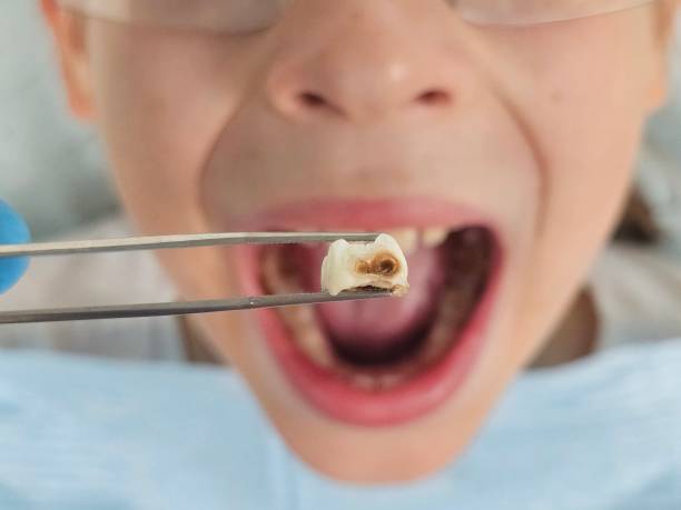 Best Emergency Gum Treatment in Ardmore, TN